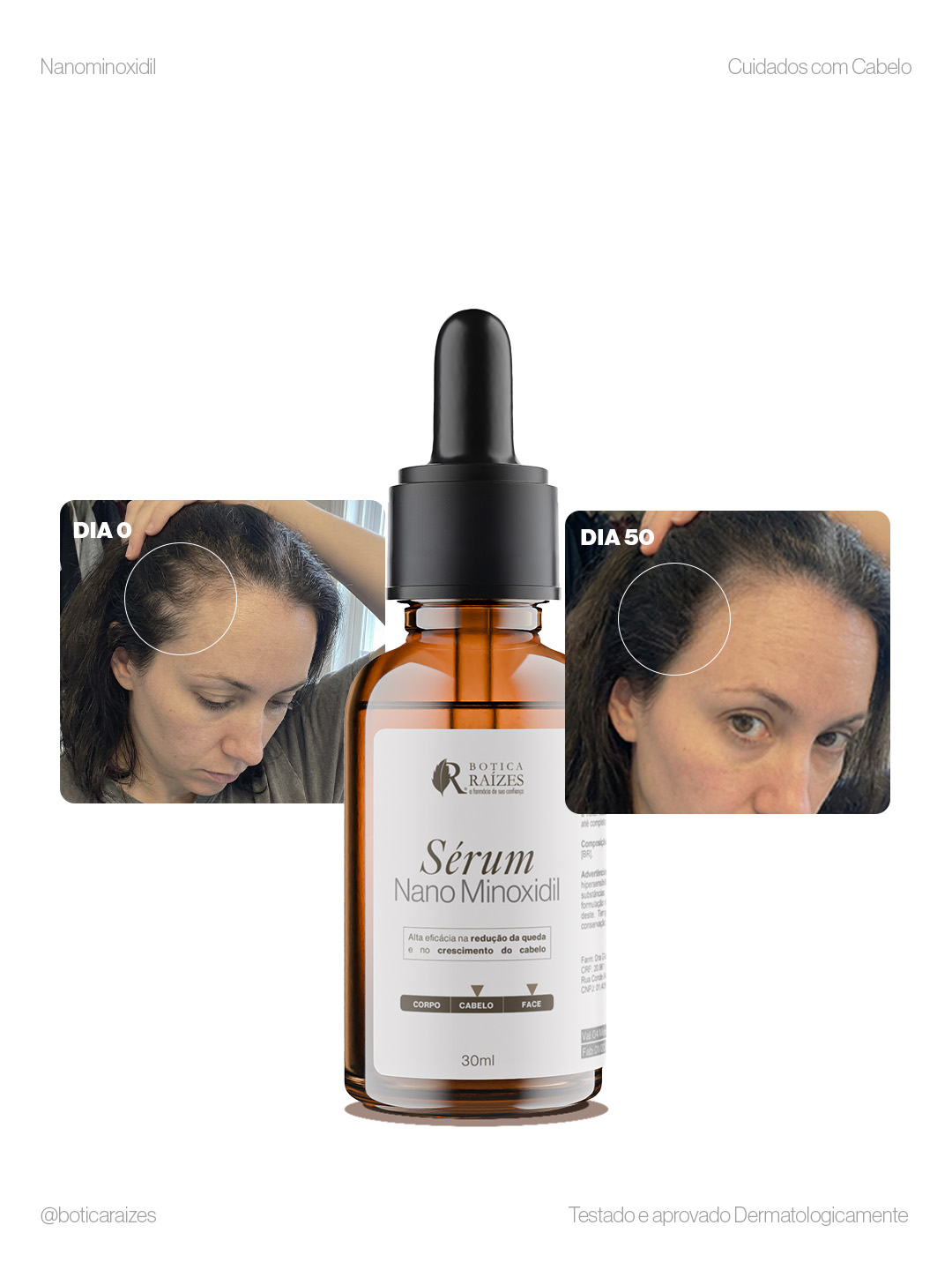 Sérum NanoMinoxidil 30ml - Imagem 4